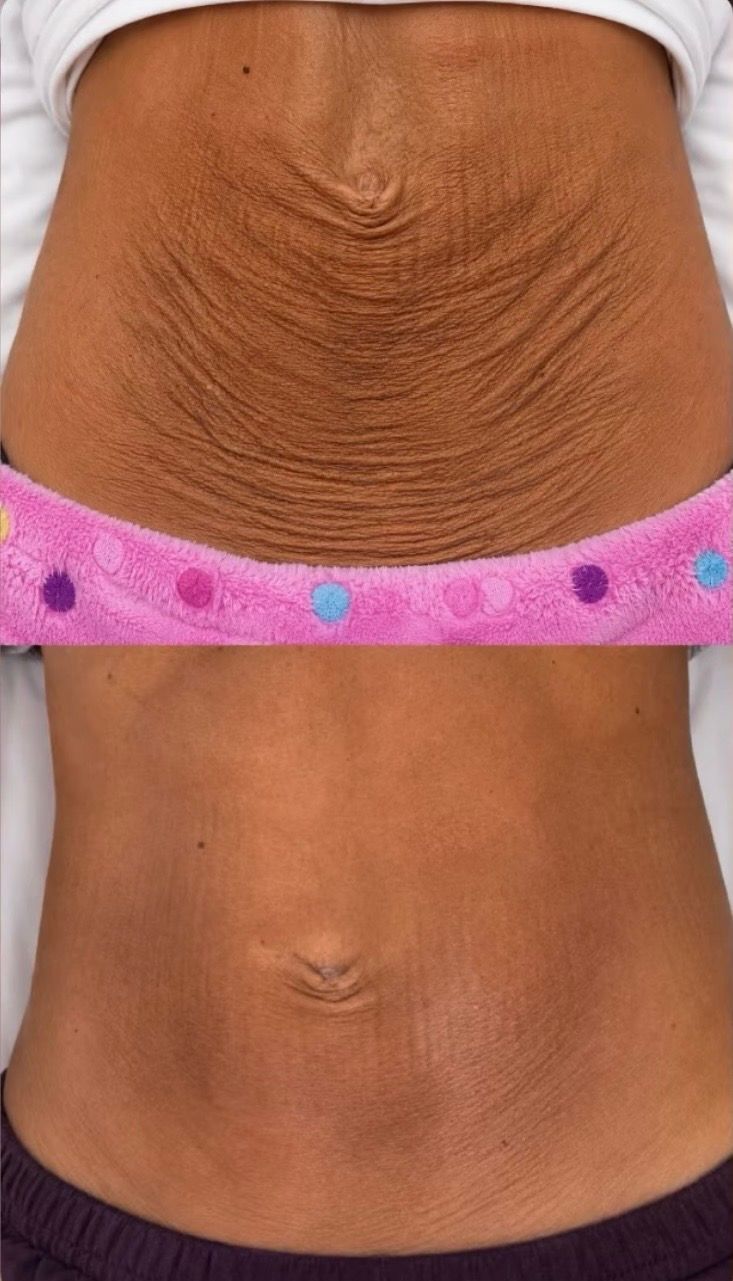 Foto 3 de Estética Débora Machado 